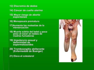 13) Discromía de dedos13) Discromía de dedos
14) Cáncer de cuello uterino14) Cáncer de cuello uterino
15)15) Mayor riesgo deMayor riesgo de abortoaborto
espontáneoespontáneo
16) Menopausia prematura16) Menopausia prematura
17)Aumenta las molestias de la17)Aumenta las molestias de la
menstruaciónmenstruación
18) Muerte súbita del bebé y poco18) Muerte súbita del bebé y poco
peso al nacer en bebés depeso al nacer en bebés de
madres fumadorasmadres fumadoras
19) Impotencia sexual y19) Impotencia sexual y
deformidad dedeformidad de
espermatozoidesespermatozoides
20) Tromboangitis obliterante20) Tromboangitis obliterante
(Enfermedad de Buerger)(Enfermedad de Buerger)
21) Eleva el colesterol21) Eleva el colesterol
 