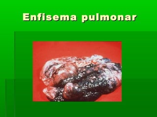 Enfisema pulmonarEnfisema pulmonar
 
