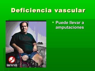 Deficiencia vascularDeficiencia vascular
 Puede llevar aPuede llevar a
amputacionesamputaciones
 