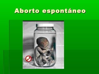 Aborto espontáneoAborto espontáneo
 