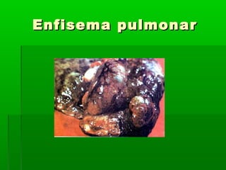 Enfisema pulmonarEnfisema pulmonar
 