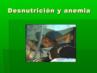 Desnutrición y anemiaDesnutrición y anemia
 