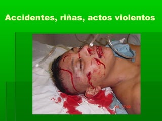 Accidentes, riñas, actos violentos
 