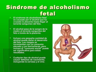 Síndrome de alcoholismoSíndrome de alcoholismo
fetalfetal
 El síndrome de alcoholismo fetalEl síndrome de alcoholismo fetal
es causado por el alcohol que haes causado por el alcohol que ha
cruzado la placenta hasta llegar alcruzado la placenta hasta llegar al
torrente sanguíneo del feto.torrente sanguíneo del feto.
 El alcohol pasa de la sangre de laEl alcohol pasa de la sangre de la
madre al torrente sanguíneo delmadre al torrente sanguíneo del
feto a través de la placenta.feto a través de la placenta.
 Incluso una pequeña cantidad deIncluso una pequeña cantidad de
alcohol puede dañar el desarrolloalcohol puede dañar el desarrollo
del feto. Los riesgos sedel feto. Los riesgos se
incrementan con un consumoincrementan con un consumo
elevado y con borracheras, peroelevado y con borracheras, pero
incluso el "consumo social" puedeincluso el "consumo social" puede
ser significativo para estosser significativo para estos
resultados.resultados.
 Cualquier tipo de alcohol puedeCualquier tipo de alcohol puede
causar defectos de nacimiento,causar defectos de nacimiento,
incluyendo la cerveza y el vino.incluyendo la cerveza y el vino.
 