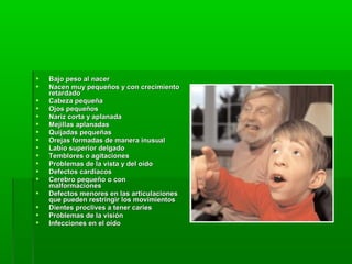  Bajo peso al nacerBajo peso al nacer
 Nacen muy pequeños y con crecimientoNacen muy pequeños y con crecimiento
retardadoretardado
 Cabeza pequeñaCabeza pequeña
 Ojos pequeñosOjos pequeños
 Nariz corta y aplanadaNariz corta y aplanada
 Mejillas aplanadasMejillas aplanadas
 Quijadas pequeñasQuijadas pequeñas
 Orejas formadas de manera inusualOrejas formadas de manera inusual
 Labio superior delgadoLabio superior delgado
 Temblores o agitacionesTemblores o agitaciones
 Problemas de la vista y del oídoProblemas de la vista y del oído
 Defectos cardiacosDefectos cardiacos
 Cerebro pequeño o conCerebro pequeño o con
malformacionesmalformaciones
 Defectos menores en las articulacionesDefectos menores en las articulaciones
que pueden restringir los movimientosque pueden restringir los movimientos
 Dientes proclives a tener cariesDientes proclives a tener caries
 Problemas de la visiónProblemas de la visión
 Infecciones en el oídoInfecciones en el oído
 