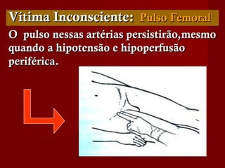 Vítima Inconsciente:Vítima Inconsciente: Pulso FemoralPulso Femoral
O pulso nessas artérias persistirão,mesmoO pulso nessas artérias persistirão,mesmo
quando a hipotensão e hipoperfusãoquando a hipotensão e hipoperfusão
periférica.periférica.
 