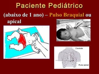 Paciente PediátricoPaciente Pediátrico
(abaixo de 1 ano) –(abaixo de 1 ano) – Pulso BraquialPulso Braquial ouou
apicalapical
 