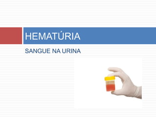 SANGUE NA URINA
HEMATÚRIA
 