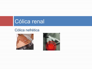 Cólica nefrética
Cólica renal
 