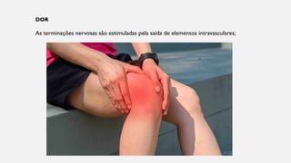 DOR
As terminações nervosas são estimuladas pela saída de elementos intravasculares;
 
