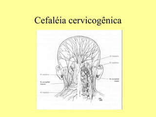 Cefaléia cervicogênica 