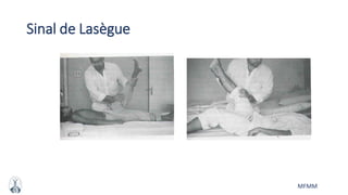 MFMM
Sinal de Lasègue
 