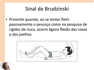 Sinal de Brudzinski
• Presente quando, ao se tentar fletir
passivamente o pescoço como na pesquisa de
rigidez de nuca, ocorre ligeira flexão das coxas
e dos joelhos
 