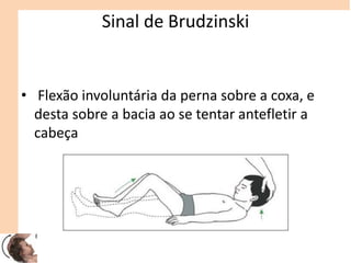 Sinal de Brudzinski
• Flexão involuntária da perna sobre a coxa, e
desta sobre a bacia ao se tentar antefletir a
cabeça
 