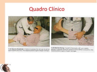 Quadro Clínico
 