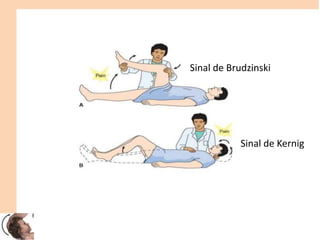 Sinal de Brudzinski
Sinal de Kernig
 