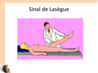 Sinal de Lasègue
 