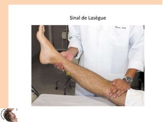 Sinal de Lasègue
 