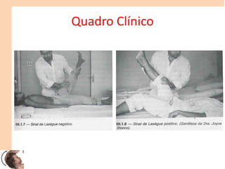 Quadro Clínico
 