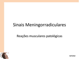 Sinais Meningorradiculares
Reações musculares patológicas
MFMM
 