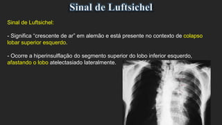 Sinal de Luftsichel:
- Significa “crescente de ar” em alemão e está presente no contexto de colapso
lobar superior esquerdo.
- Ocorre a hiperinsulflação do segmento superior do lobo inferior esquerdo,
afastando o lobo atelectasiado lateralmente.
 