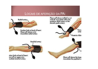 LOCAIS DE AFERIÇÃO DA PA:
 