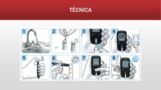 TÉCNICA
 