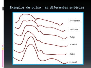 Exemplos de pulso nas diferentes artérias
 