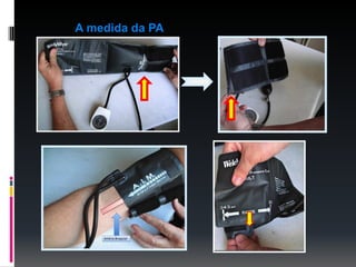 A medida da PA
 