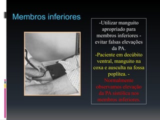 -Utilizar manguito
apropriado para
membros inferiores -
evitar falsas elevações
da PA.
-Paciente em decúbito
ventral, manguito na
coxa e ausculta na fossa
poplítea. -
Normalmente
observamos elevação
da PA sistólica nos
membros inferiores.
Membros inferiores
 