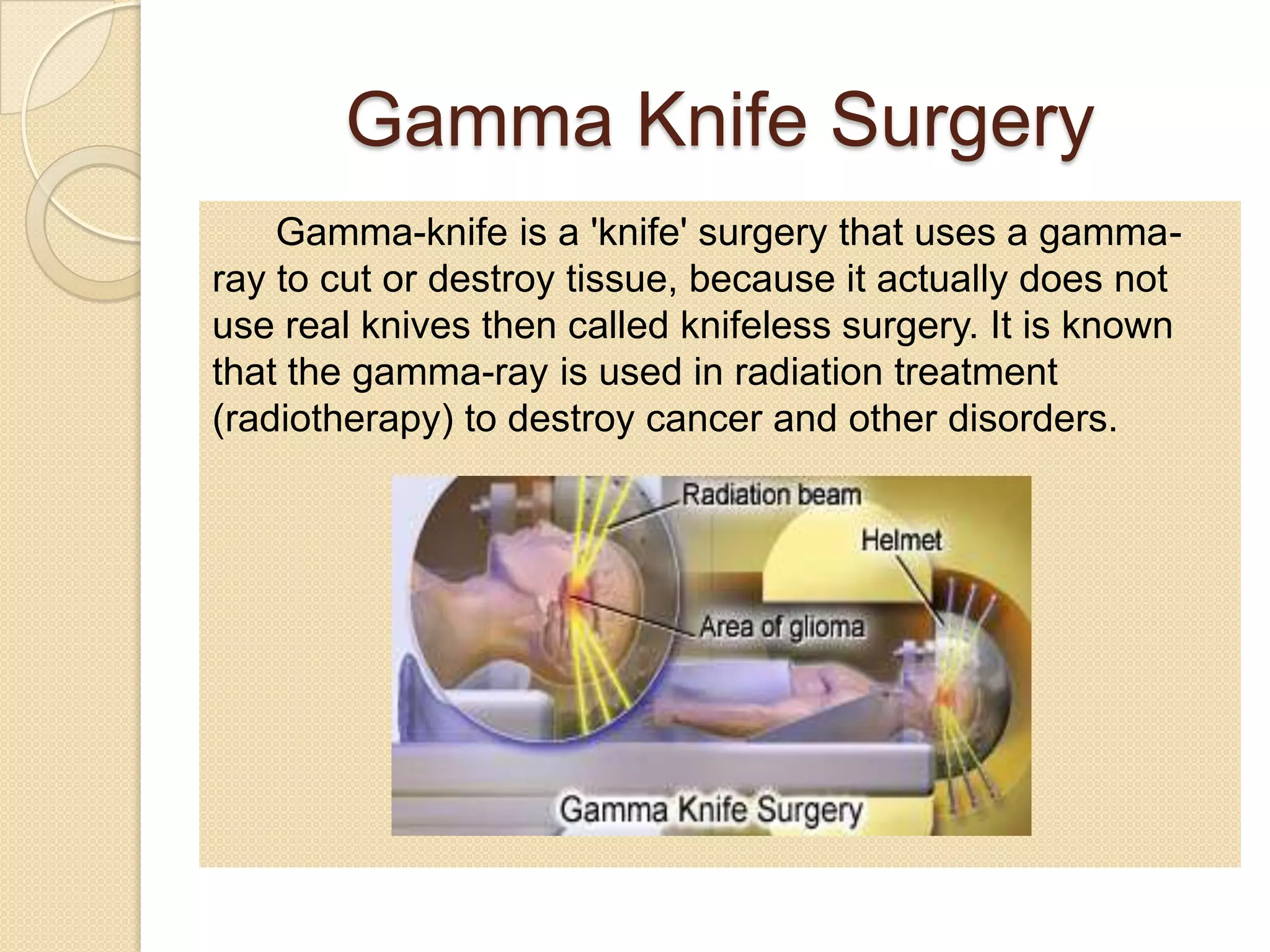 Gamma Knife Surgery
Gamma-knife is a 'knife' surgery that uses a gamma-
ray to cut or destroy tissue, because it actually does not
use real knives then called knifeless surgery. It is known
that the gamma-ray is used in radiation treatment
(radiotherapy) to destroy cancer and other disorders.
 