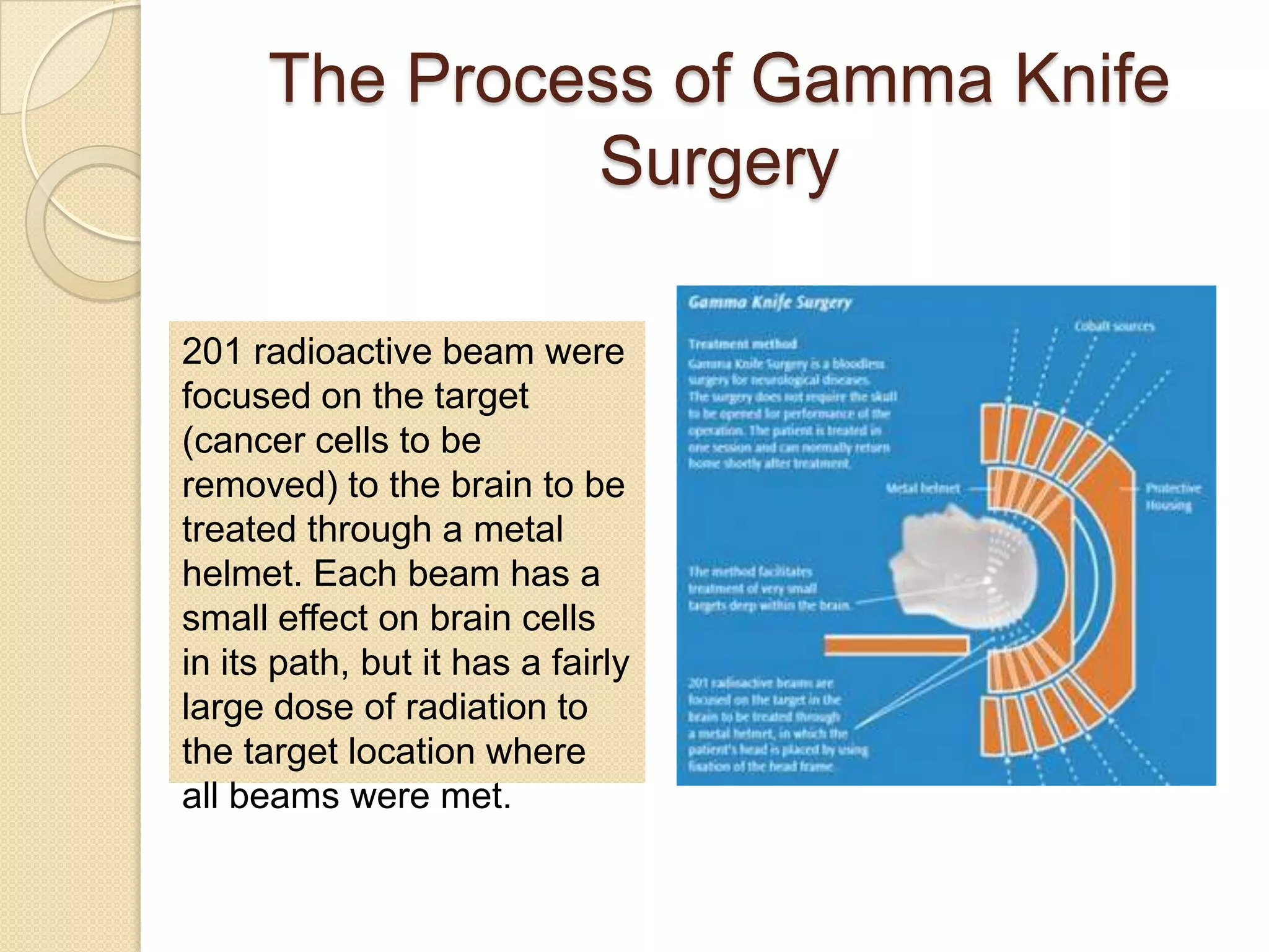 The Process of Gamma Knife
Surgery
201 radioactive beam were
focused on the target
(cancer cells to be
removed) to the brain to be
treated through a metal
helmet. Each beam has a
small effect on brain cells
in its path, but it has a fairly
large dose of radiation to
the target location where
all beams were met.
 