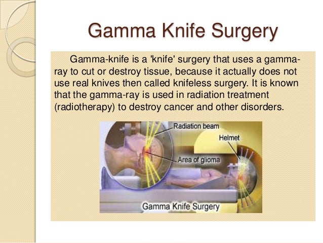 gamma rays in radiotherapy Radiation therapy radiotherapy administration of ionizing radiation to treat disease, gamma rays are high-energy photons,. gamma rays in radiotherapy Radiation therapy radiotherapy administration of ionizing radiation to treat disease, gamma rays are high-energy photons,.