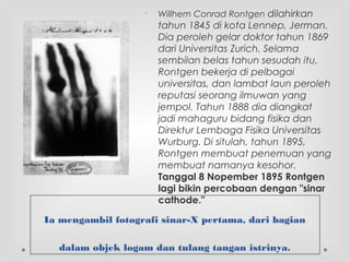 •
Willhem Conrad Rontgen dilahirkan
tahun 1845 di kota Lennep, Jerman.
Dia peroleh gelar doktor tahun 1869
dari Universitas Zurich. Selama
sembilan belas tahun sesudah itu,
Rontgen bekerja di pelbagai
universitas, dan lambat laun peroleh
reputasi seorang ilmuwan yang
jempol. Tahun 1888 dia diangkat
jadi mahaguru bidang fisika dan
Direktur Lembaga Fisika Universitas
Wurburg. Di situlah, tahun 1895,
Rontgen membuat penemuan yang
membuat namanya kesohor.
Tanggal 8 Nopember 1895 Rontgen
lagi bikin percobaan dengan "sinar
cathode."
Ia mengambil fotografi sinar-X pertama, dari bagian
dalam objek logam dan tulang tangan istrinya.
 