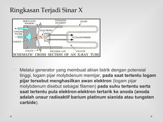 •
Melalui generator yang membuat aliran listrik dengan potensial
tinggi, logam pijar molybdenum memijar, pada saat tertentu logam
pijar tersebut menghasilkan awan elektron (logam pijar
molybdenum disebut sebagai filamen) pada suhu tertentu serta
saat tertentu pula elektron-elektron tertarik ke anoda (anoda
adalah unsur radioaktif barium platinum sianida atau tungsten
carbide).
Ringkasan Terjadi Sinar X
 