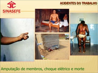 Amputação de membros, choque elétrico e morte 
