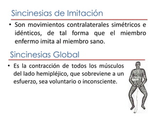 Clasificación Sincinesias Normales Sincinesias Patológicas Sincinesias de imitación Sincinesia Global Sincinesias de Coordinación