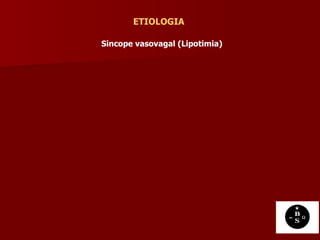 ETIOLOGIA Sincope vasovagal (Lipotimia)   