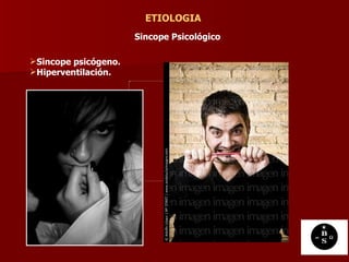 ETIOLOGIA Sincope Psicológico   Sincope psicógeno. Hiperventilación. 