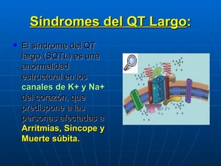 Síndromes del QT Largo : El síndrome del QT   largo (SQTL) es una anormalidad estructural en los  canales de K+ y Na+   del corazón, que predispone a las personas afectadas a  Arritmias, Síncope y Muerte súbita. 