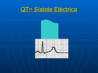 QT= Sístole Eléctrica 