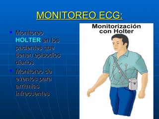 MONITOREO ECG: Monitoreo  HOLTER  en los pacientes que tienen episodios diarios Monitoreo de eventos para arritmias infrecuentes 