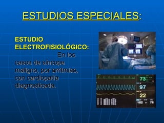ESTUDIOS ESPECIALES : ESTUDIO ELECTROFISIOLÓGICO:   En los casos de síncope maligno, por arritmias, con cardiopatía diagnosticada. 