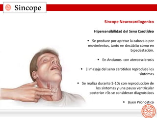 Sincope
Sincope Neurocardiogenico
Hipersensibilidad del Seno Carotídeo
 Se produce por apretar la cabeza o por
movimientos, tanto en decúbito como en
bipedestación.
 En Ancianos con ateroesclerosis
 El masaje del seno carotídeo reproduce los
síntomas
 Se realiza durante 5-10s con reproducción de
los síntomas y una pausa ventricular
posterior >3s se consideran diagnósticos
 Buen Pronostico
 