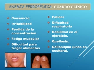  Cansancio
 Irritabilidad
 Perdida de la
concentración
 Fatiga muscular
 Dificultad para
tragar alimentos
 Palidez
 Dificultad
respiratoria
 Debilidad en el
ejercicio.
 Queilosis.
 Coiloniquia (unas en
cuchara).
ANEMIA FERROPÉNICA: CUADRO CLÍNICO
 