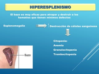 Esplenomegalia Destrucción de células sanguíneas
Citopenia:
Anemia
Granulocitopenia
Trombocitopenia
HIPERESPLENISMO
El bazo es muy eficaz para atrapar y destruir a los
hematíes que tienen mínimos defectos
 