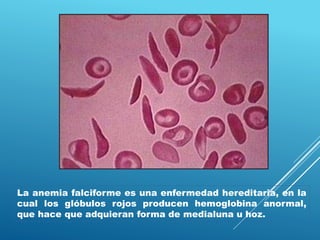 La anemia falciforme es una enfermedad hereditaria, en la
cual los glóbulos rojos producen hemoglobina anormal,
que hace que adquieran forma de medialuna u hoz.
 
