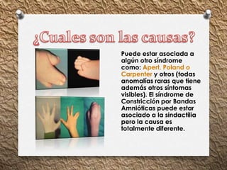 Puede estar asociada a
algún otro síndrome
como: Apert, Poland o
Carpenter y otros (todas
anomalías raras que tiene
además otros síntomas
visibles). El síndrome de
Constricción por Bandas
Amnióticas puede estar
asociado a la sindactilia
pero la causa es
totalmente diferente.
 
