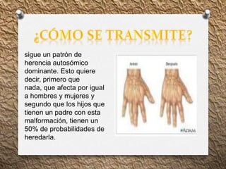 sigue un patrón de
herencia autosómico
dominante. Esto quiere
decir, primero que
nada, que afecta por igual
a hombres y mujeres y
segundo que los hijos que
tienen un padre con esta
malformación, tienen un
50% de probabilidades de
heredarla.
 