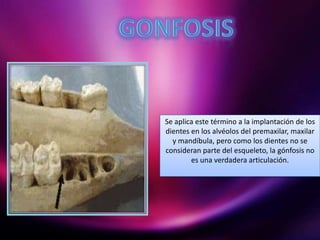 Se aplica este término a la implantación de los
dientes en los alvéolos del premaxilar, maxilar
y mandíbula, pero como los dientes no se
consideran parte del esqueleto, la gónfosis no
es una verdadera articulación.